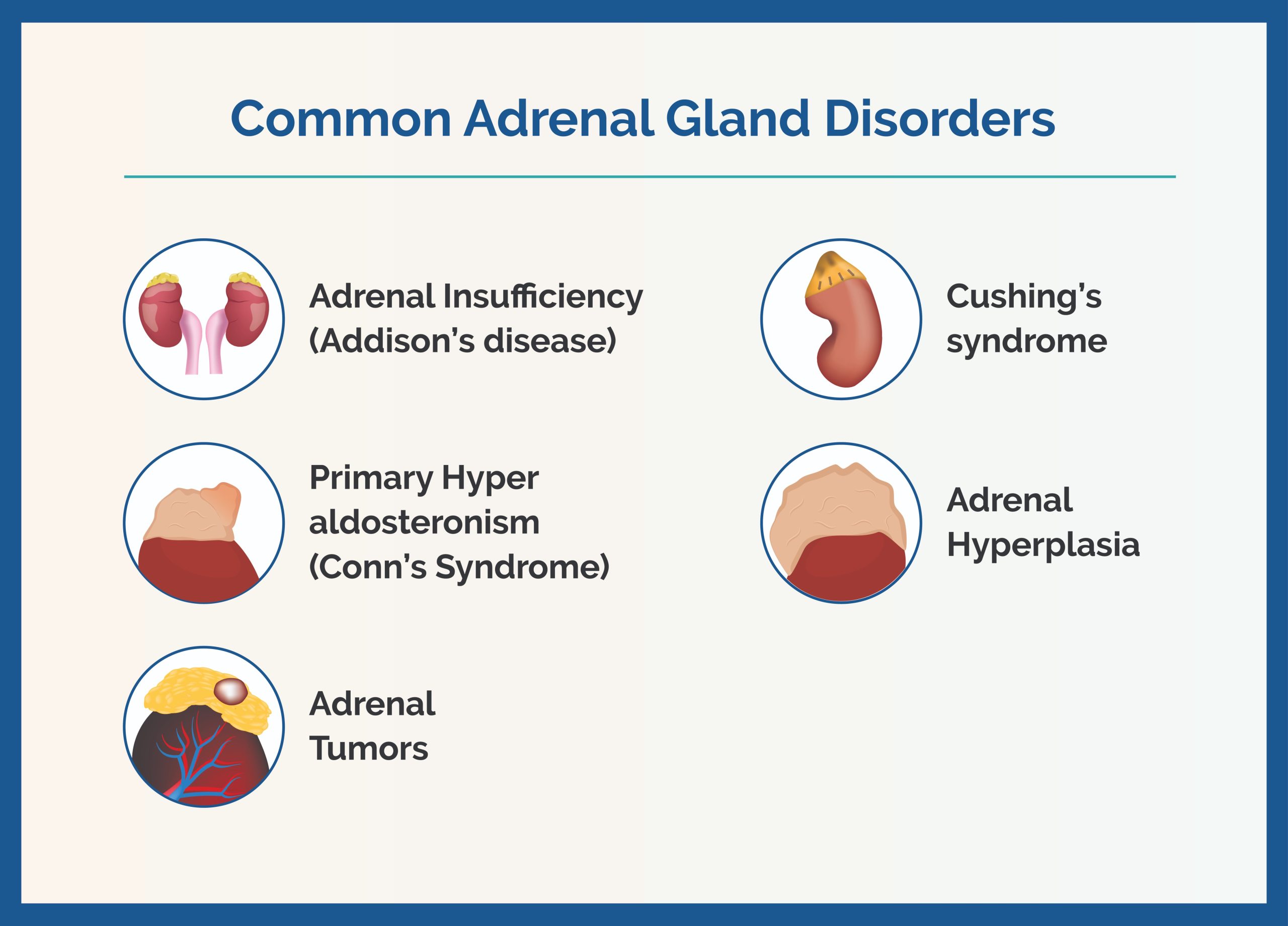 Adrenal Gland Tumours: Symptoms, Diagnosis, & Treatment Options