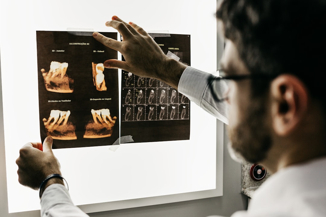 All You Need to Know About Dental Surgery